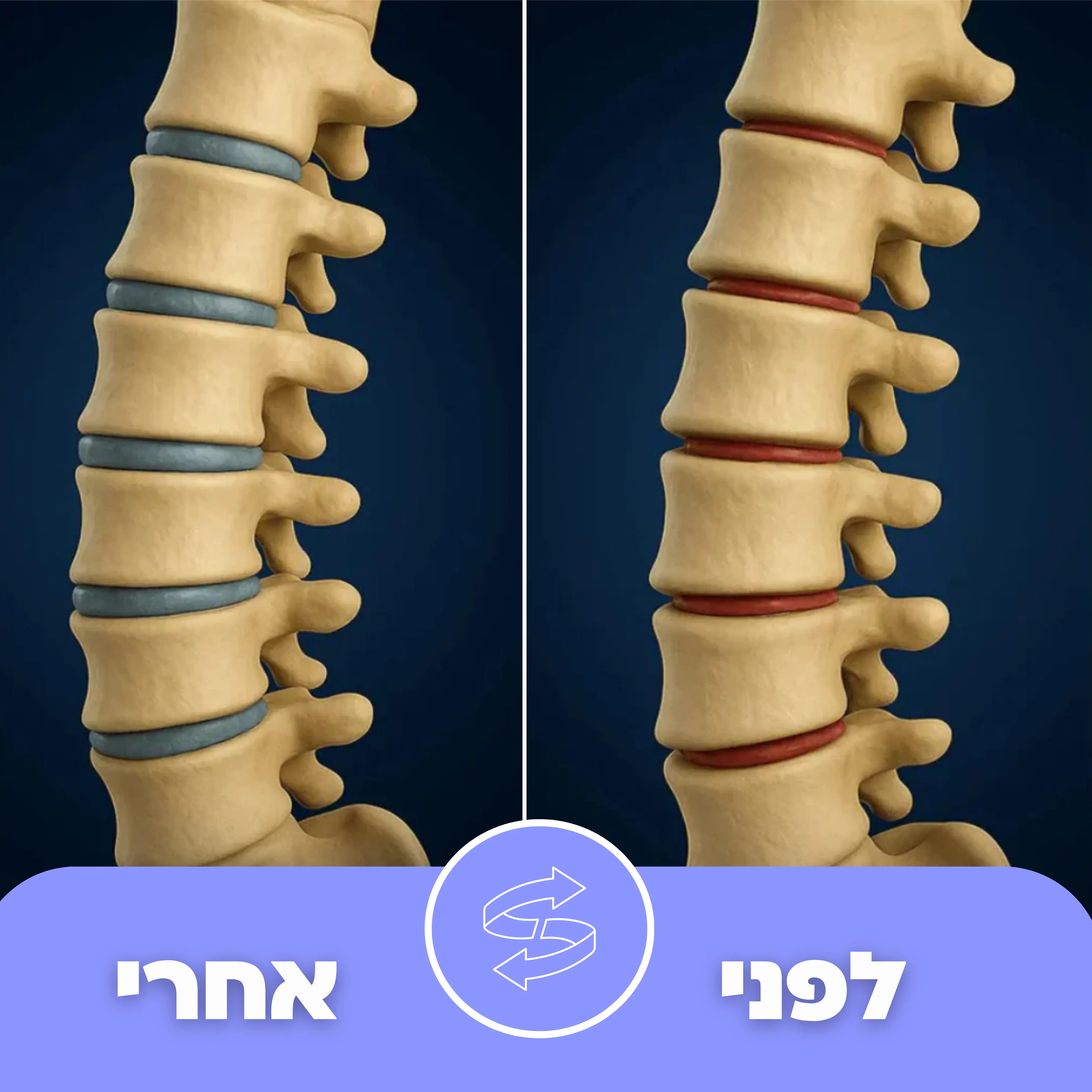 כרית טיפול הגב Back+ - Image 7